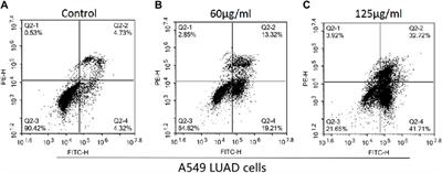 Molecular mechanism of the treatment of lung adenocarcinoma by Hedyotis Diffusa: an integrative study with real-world clinical data and experimental validation